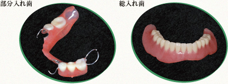 保険義歯