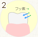 STEP2